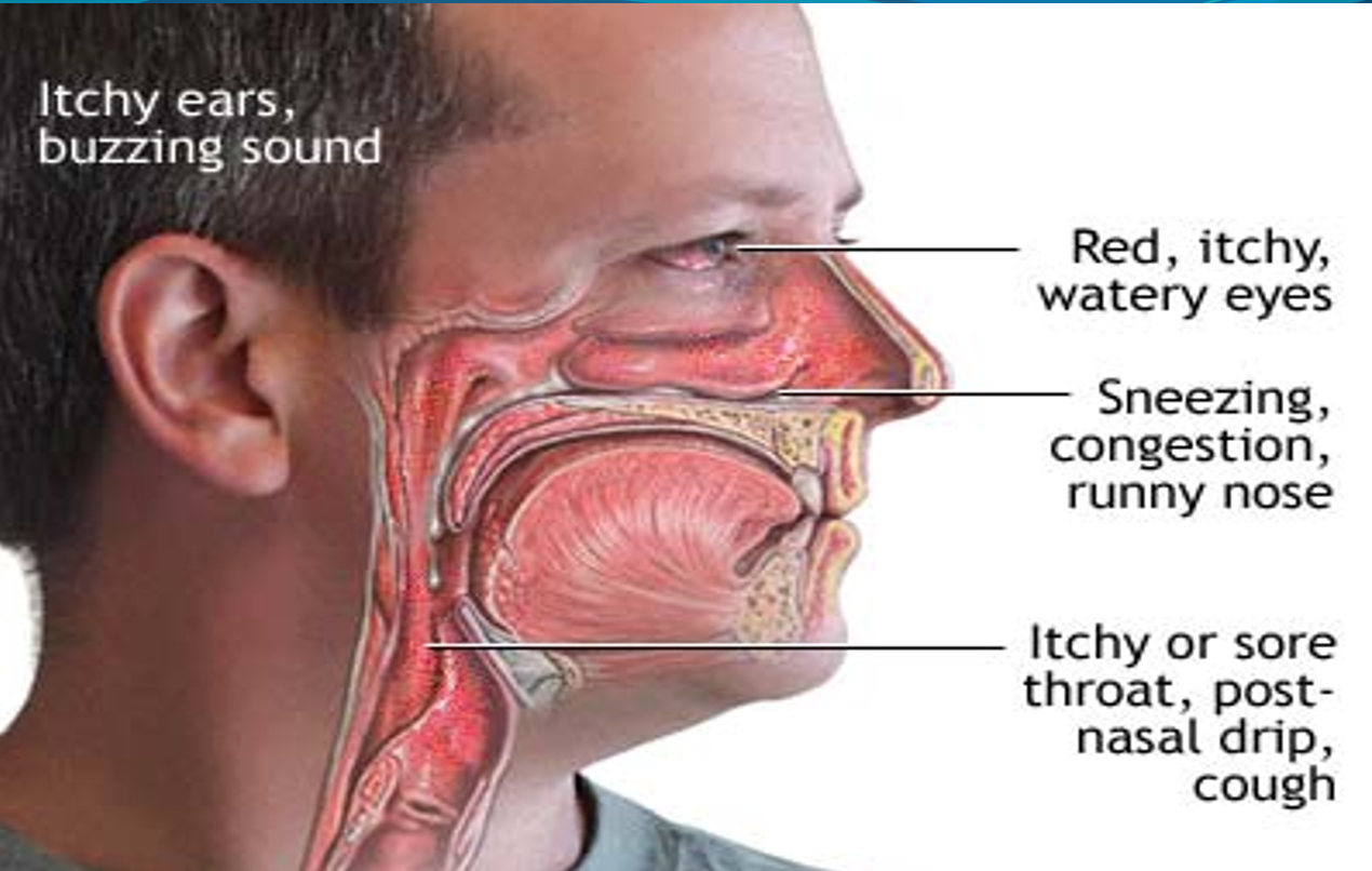 Mold Symptoms - TampaBayMold.net